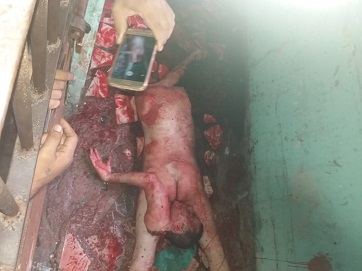 Aftermath of Deadly Prison Riot in Brazil