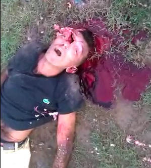 Dead with One of the Biggest hole  in a Head I've ever Seen