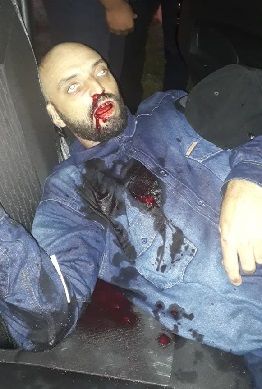 Police Officer Riddled with Bullets While Driving Down Dangerous Road in Brazil