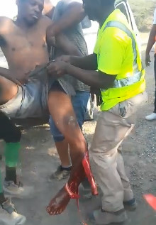 OH HELL.....Poor Guy with Nasty Leg Break 