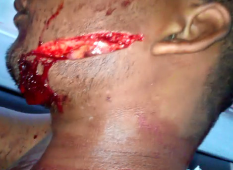 Man Slashed Across Face with Machetes by Rival Gang Members in Brazil