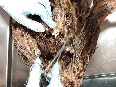 Female reproductive system gross