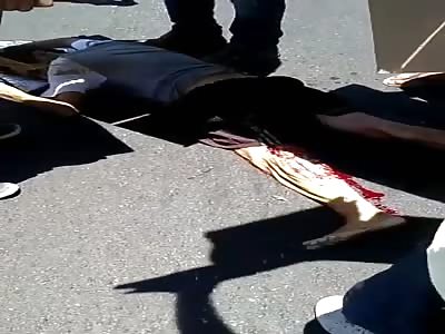 man tears the skin of his leg when crushed by truck