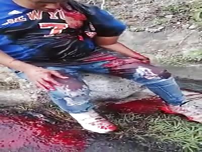 WTF: man had a serious accident and almost lost an arm