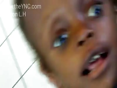 5 year old girl with disorders