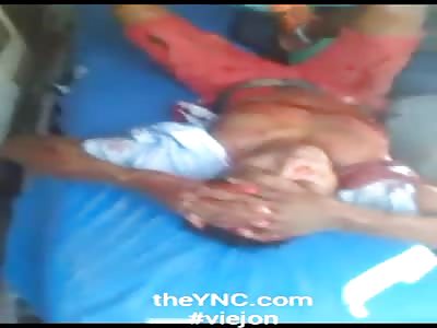 Injured in corraleja