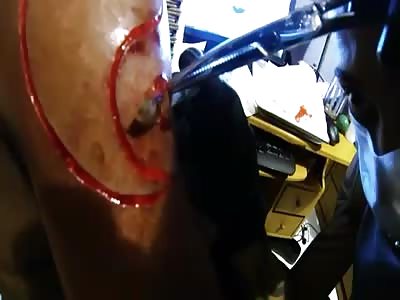 Tattoo scarification