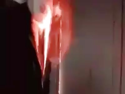 Teenager stupid gets his face burned by internet trends