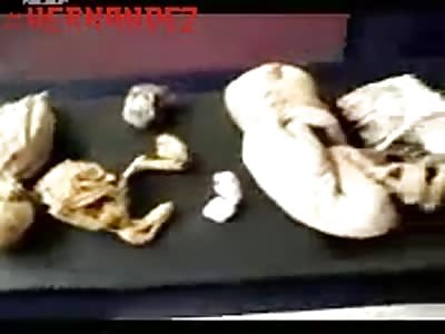 Collection of fetuses