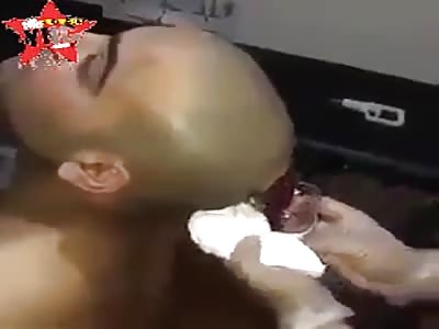 Horrible homeopathic procedure