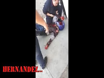 boy loses eye in fatal accident