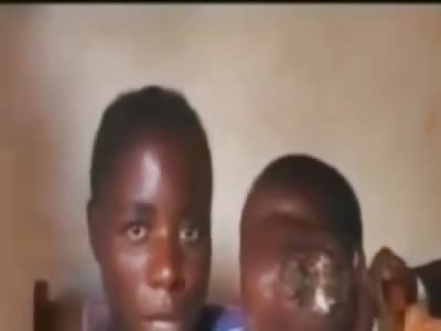 Young boy with massive facial tumour.