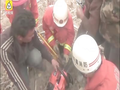 Man in agony with a chainsaw stuck in his leg.