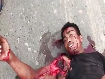 motorcyclist badly fucked up after hitting a car