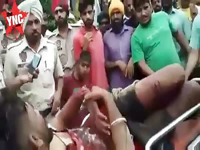 Mans hand almost severed after attack