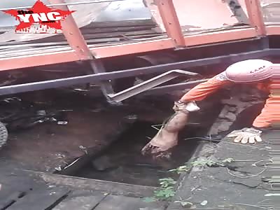 Removing a severed leg from truck wreckage