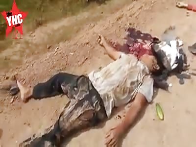 Head crushed after accident