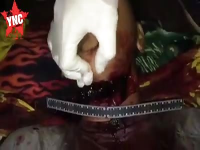 Mans throat was slit wide open