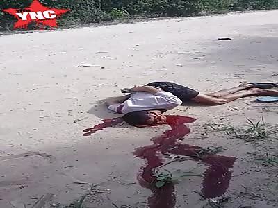 Youth was shot in the head