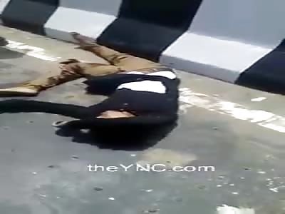 Broken leg and broken head after accident