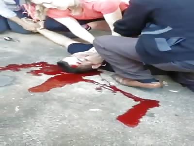 Trying to revive youth bleeding out from his head