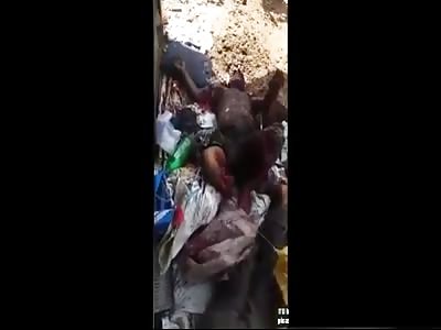Mans leg hanging off after gas cylinder exploded