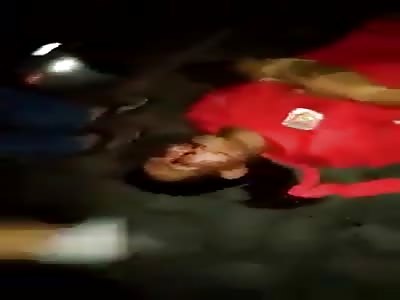 Man Badly Bruised and Bleeding after Being Attacked 