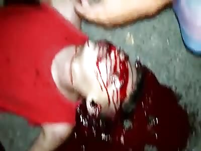 Gunshot to the Head Left Thugs Blood All Over the Concrete