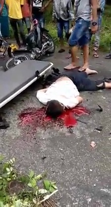 Motorcyclists Head Got Cracked Open