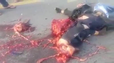 Mans Lower Half Was Turned into Shredded Meat