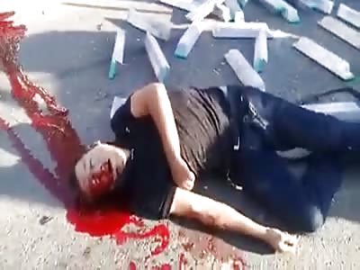 Man Dying in his Own Blood After Accident