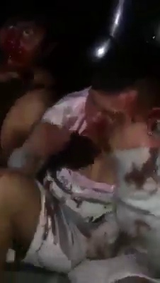 Bloodied Thieves Get Kicked