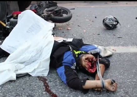 Biker Had His Face Totally Caved In