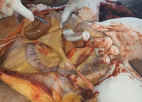 Removing Guts from Dead Old Man in India