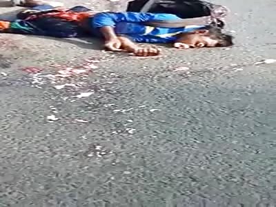 Biker Dead With a Fucked Up Face 