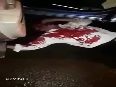 Taxi Driver Dying After Getting Shot by Police in Nicaragua 