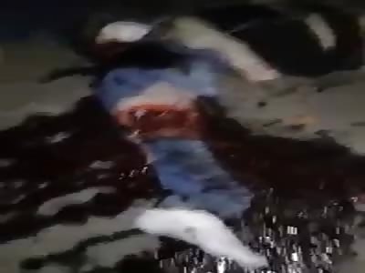 Biker Doing the Splits After Accident