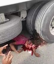 Gore: Head Cracked and Brain Spilling Out on The Road