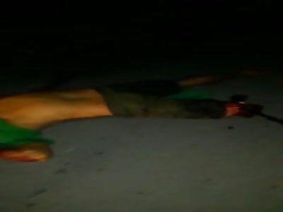 Brutal Aftermath of Biker With Leg Torn Off