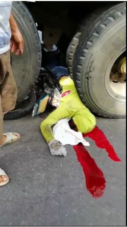 Crushed Biker Still Alive in Vietnam Somehow 