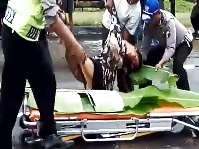 Floppy Dead Woman After Accident