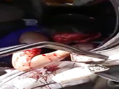 Young Woman Agonizes inside Totalled Car