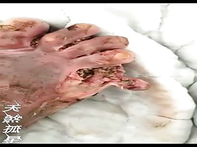 Man has Fucking Disgusting Maggot Feet