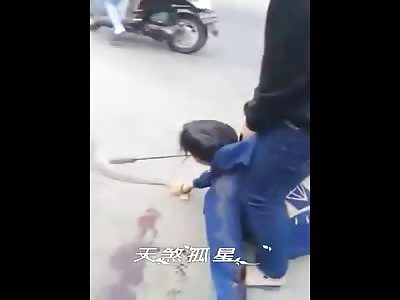 Damn! Kid Gets Huge Blade Stuck in His Face - Dies Later