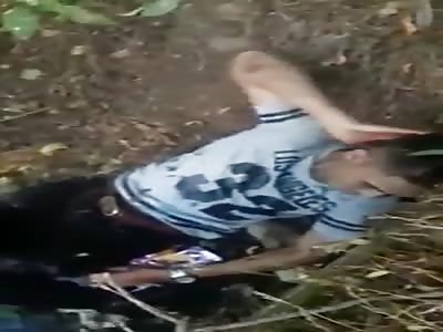 Biker Accident With Wrecked Legs