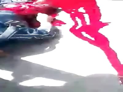 Damn... Still Alive Man With His Legs Totally Ripped Up