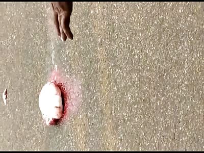 Biker Had his Brain Ejected into the Road