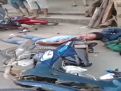 Biker Got Face Pierced on Bike Seat in Vietnam