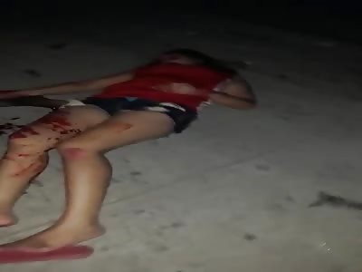 Young Woman in Accident 