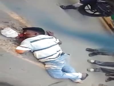  Accident With Popped Eye